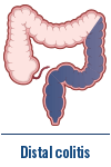 Distal colitis